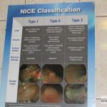 kolonoskopia badania profilaktyczne MCZ szpital010