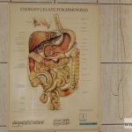 kolonoskopia badania profilaktyczne MCZ szpital012