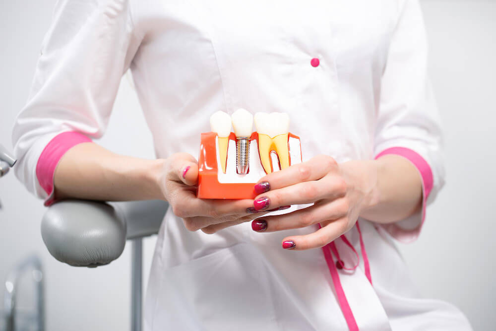 Implanty stomatologiczne – kiedy są potrzebne i jak wykonuje się je współcześnie?