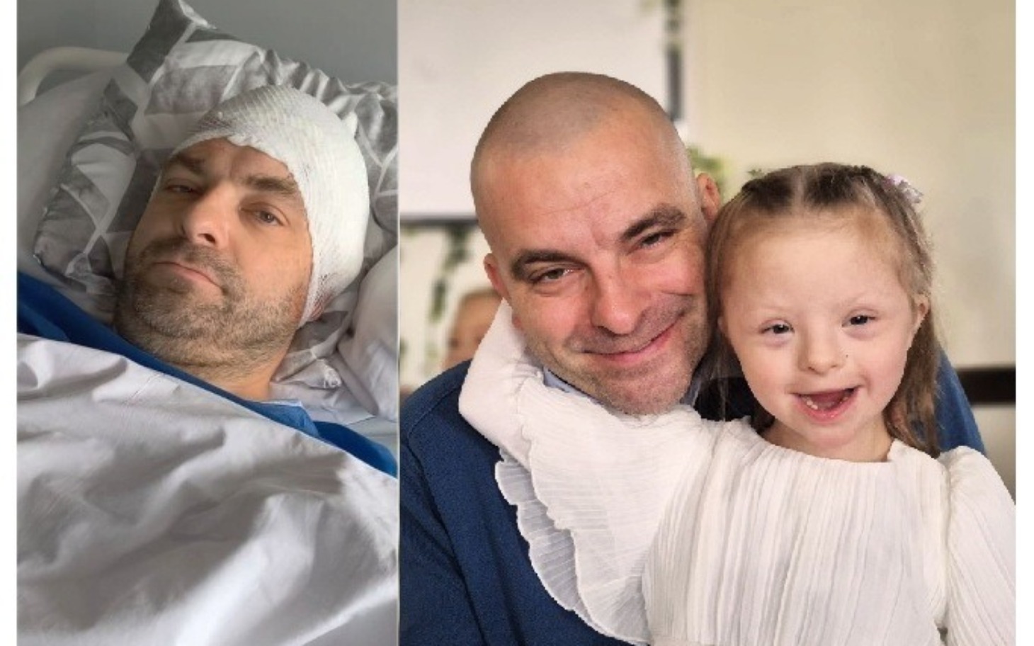 Filip walczy o życie. Trwa zbiórka na leczenie