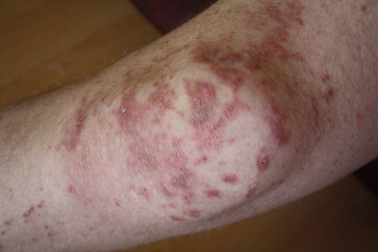 Uwaga na barszcz Sosnowskiego!