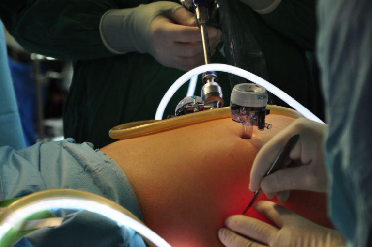 Chirurdzy walczą z otyłością (VIDEO)