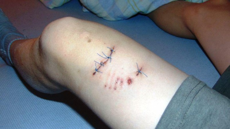 Pies pogryzł 8-latka