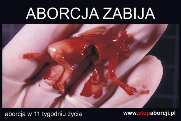 Terapia szokowa