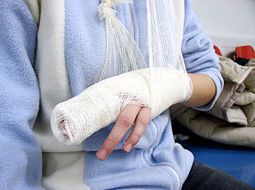 Gips2.jpg
